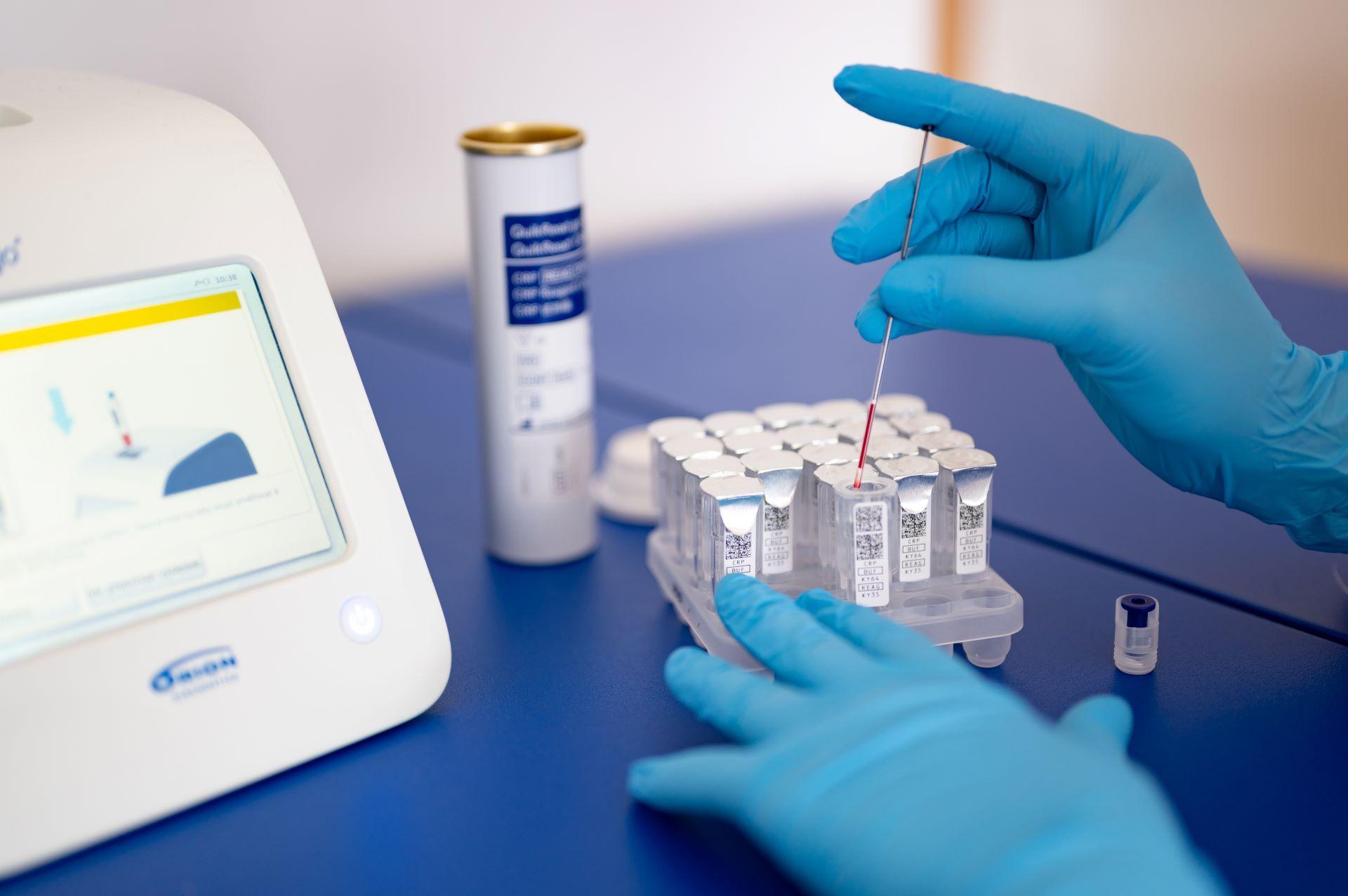 Blutprobe im Labor für Test